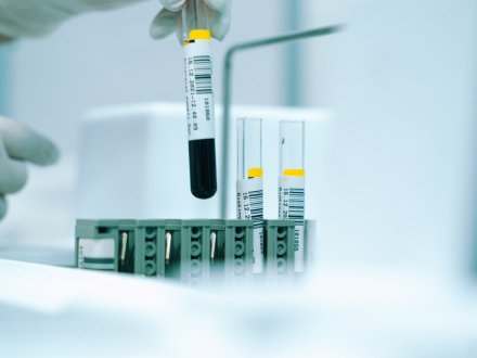 Gloved hand holding a test tube in a laboratory